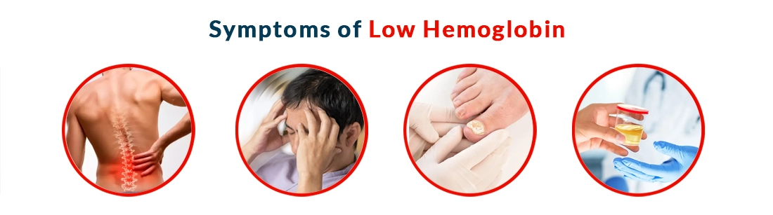 Symptoms of Low Hemoglobin